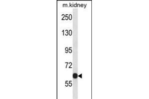 KCNC2 Antibody (C-term) (ABIN657792 and ABIN2846765) western blot analysis in mouse kidney tissue lysates (35 μg/lane). (KCNC2 抗体  (C-Term))