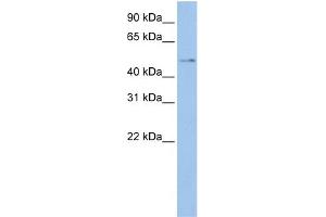 WB Suggested Anti-TSPYL4  Antibody Titration: 0. (TSPY-Like 4 抗体  (Middle Region))