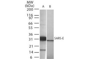 Image no. 1 for anti-SARS-Coronavirus Envelope Protein (SARS-CoV E) (AA 59-70) antibody (ABIN199987) (SARS-Coronavirus Envelope Protein 抗体  (AA 59-70))