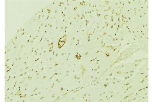 ABIN6276740 at 1/100 staining Mouse brain tissue by IHC-P. (THRB 抗体  (Internal Region))