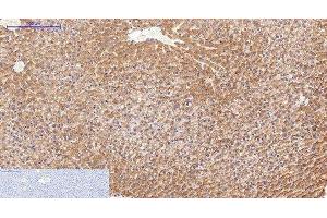 Immunohistochemistry of paraffin-embedded Rat liver tissue using FN1 Monoclonal Antibody at dilution of 1:200. (Fibronectin 1 抗体)