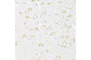 Immunohistochemistry (Paraffin-embedded Sections) (IHC (p)) image for anti-Sequestosome 1 (SQSTM1) (AA 1-440) antibody (ABIN6148419)