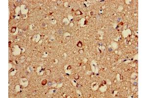 Immunohistochemistry of paraffin-embedded human brain tissue using ABIN7149167 at dilution of 1:100 (COX5A 抗体  (AA 42-150))