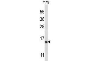NR2C2AP Antibody (N-term) western blot analysis in Y79 cell line lysates (35µg/lane). (NR2C2AP 抗体  (N-Term))