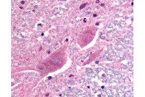 Immunohistochemistry (IHC) image for anti-Sodium Channel, Voltage-Gated, Type III, alpha Subunit (SCN3A) (C-Term) antibody (ABIN1049320)