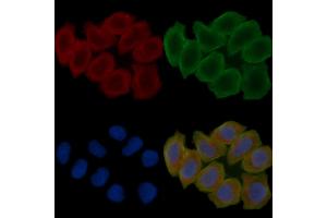 ABIN6266289 and ABIN6277345 staining Hela cells(30 min of UV treatment) by IF/ICC. (USO1 抗体  (C-Term))