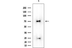 anti-Suppressor of Cancer Cell Invasion (SCAI) antibody