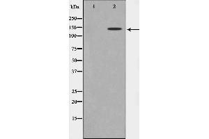 Western blot analysis on Jurkat cell lysate using MAST3 Antibody,The lane on the left is treated with the antigen-specific peptide. (MAST3 抗体  (Internal Region))