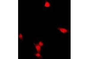 Immunofluorescent analysis of ZNF397 staining in HepG2 cells. (ZNF397 抗体  (N-Term))