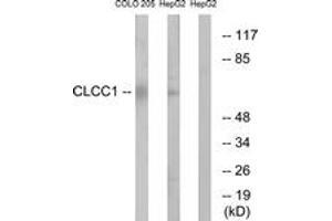 Western blot analysis of extracts from COLO/HepG2 cells, using CLCC1 Antibody. (CLCC1 抗体  (AA 391-440))