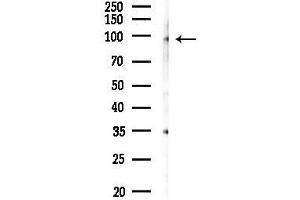 Western blot analysis of lysates from Mouse lung, using MEPE Antibody at 1/1000 dilution.