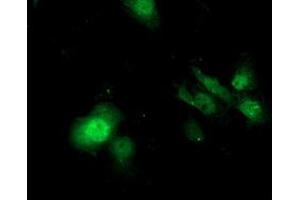Anti-SDS mouse monoclonal antibody (ABIN2455350) immunofluorescent staining of COS7 cells transiently transfected by pCMV6-ENTRY SDS (RC217814). (serine Dehydratase 抗体)