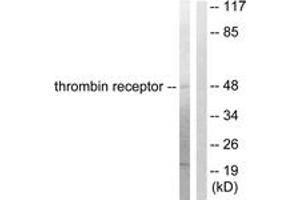Western blot analysis of extracts from HeLa cells, treated with Nocodazole 1ug/ml 18h, using Thrombin Receptor Antibody.