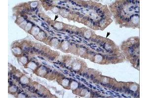 Image no. 1 for anti-Sphingomyelin phosphodiesterase, Acid-Like 3B (SMPDL3B) (AA 88-137) antibody (ABIN6735957) (SMPDL3B 抗体  (AA 88-137))