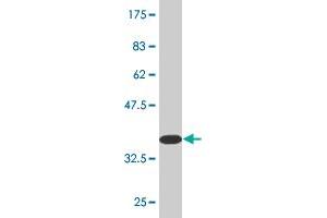 Western Blot detection against Immunogen (35. (RGS5 抗体  (AA 94-181))