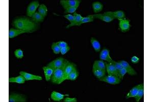 Immunofluorescent analysis of HepG2 cells using ABIN7158447 at dilution of 1:100 and Alexa Fluor 488-congugated AffiniPure Goat Anti-Rabbit IgG(H+L) (LOXHD1 抗体  (AA 1101-1366))