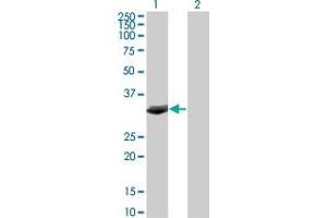 Western Blot analysis of FBXO6 expression in transfected 293T cell line by FBXO6 monoclonal antibody (M01), clone 3F10. (FBXO6 抗体  (AA 1-293))