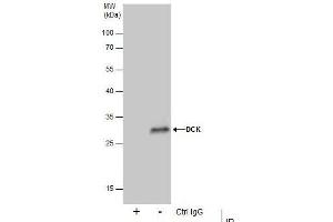Immunoprecipitation (IP) image for anti-Deoxycytidine Kinase (DCK) antibody (ABIN2855484)