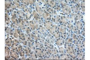 Immunohistochemistry (IHC) image for anti-Transforming, Acidic Coiled-Coil Containing Protein 3 (TACC3) antibody (ABIN1498098) (TACC3 抗体)