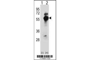 Western blot analysis of DARS using rabbit polyclonal DARS Antibody using 293 cell lysates (2 ug/lane) either nontransfected (Lane 1) or transiently transfected (Lane 2) with the DARS gene. (DARS 抗体  (N-Term))