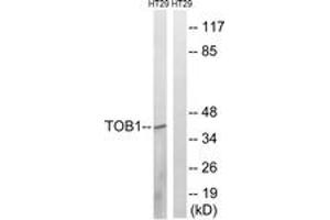 Western blot analysis of extracts from HT-29 cells, treated with serum 20% 15', using TOB1 (Ab-164) Antibody. (Protein Tob1 (TOB1) (AA 130-179) 抗体)