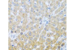 Immunohistochemistry of paraffin-embedded Human liver using IL20 Polyclonal Antibody at dilution of 1:100 (40x lens). (IL-20 抗体)