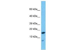 Western Blotting (WB) image for anti-HD Domain Containing 2 (HDDC2) (N-Term) antibody (ABIN2787774) (HDDC2 抗体  (N-Term))