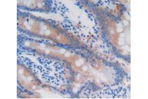 Figure. (GSTA4 抗体  (AA 2-222))