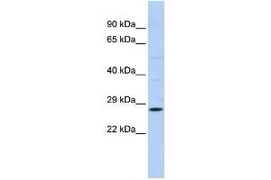 Western Blotting (WB) image for anti-RAB38, Member RAS Oncogene Family (RAB38) antibody (ABIN2458672) (RAB38 抗体)