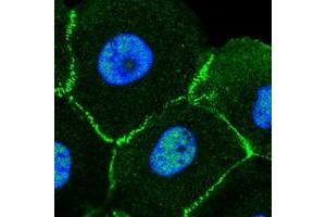 Immunofluorescent staining of human cell line A-431 with MLLT4 polyclonal antibody  at 1-4 ug/mL dilution shows positivity in nucleus but not nucleoli, plasma membrane and cell junctions. (Afadin 抗体)
