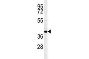 CCR8 antibody western blot analysis in MDA-MB435 lysate (CCR8 抗体  (AA 290-317))