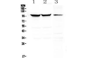 Western blot analysis of Dynamin 1 using anti-Dynamin 1 antibody . (Dynamin 1 抗体  (AA 616-667))