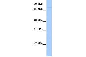 WB Suggested Anti-SAMD4A Antibody Titration: 0. (SAMD4A 抗体  (Middle Region))