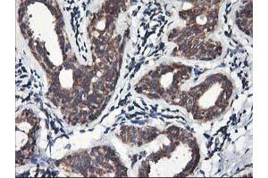 Immunohistochemical staining of paraffin-embedded Human breast tissue using anti-HMOX2 mouse monoclonal antibody. (HMOX2 抗体)