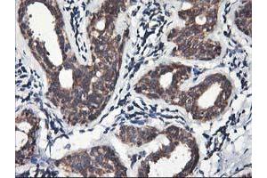 Immunohistochemical staining of paraffin-embedded Human breast tissue using anti-HMOX2 mouse monoclonal antibody. (HMOX2 抗体)