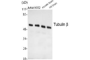 Western Blot analysis of Jurkat (1), K562 (2), mouse brain (3), rat brain (4), diluted at 1:2000. (TUBB 抗体  (AA 370-450))