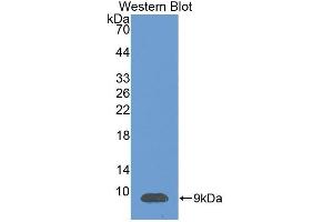 Detection of Recombinant SDF1, Human using Polyclonal Antibody to Stromal Cell Derived Factor 1 (SDF1)