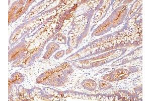 Image no. 1 for anti-Carcinoembryonic Antigen-Related Cell Adhesion Molecule 5 (CEACAM5) antibody (ABIN6152084)