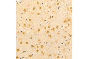 Immunohistochemistry (Paraffin-embedded Sections) (IHC (p)) image for anti-Bromodomain PHD Finger Transcription Factor (BPTF) antibody (ABIN7073234)