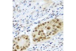 Immunohistochemistry (IHC) image for anti-Proteasome (Prosome, Macropain) Subunit, beta Type 2 (PSMB2) antibody (ABIN7306308)