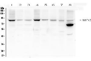 Western blot analysis of Mitofusin 2 using anti- Mitofusin 2 antibody . (MFN2 抗体  (AA 601-757))