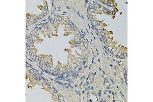 Immunohistochemistry of paraffin-embedded human prostate using LITAF Antibody (ABIN1876657) at dilution of 1:100 (40x lens). (LITAF 抗体)