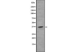Western blot analysis of Cathepsin H using K562 whole cell lysates (Cathepsin H 抗体  (Internal Region))