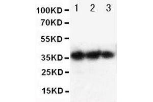 Anti-human EPO antibody, Western blotting Lane 1: Recombinant human EPO Protein 10ng Lane 2: Recombinant human EPO Protein 5ng Lane 3: Recombinant human EPO Protein 2 (EPO 抗体  (AA 1-166))