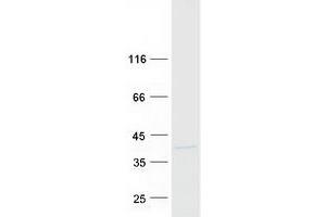 Charged Multivesicular Body Protein 2A (CHMP2A) (Transcript Variant 2) protein (Myc-DYKDDDDK Tag)