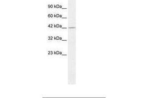 Image no. 1 for anti-Proteasome (Prosome, Macropain) 26S Subunit, Non-ATPase, 4 (Psmd4) (C-Term) antibody (ABIN6735881)