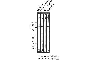 Western blot analysis of Phospho-FGFR1 (Tyr654) expression in various lysates (FGFR1 抗体  (pTyr654))