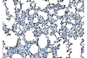 IHC analysis of Dectin-1/Clec7a using anti-Dectin-1/Clec7a antibody (ABIN7600251).