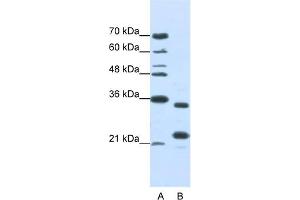 WB Suggested Anti-ALKBH8 Antibody Titration:  1. (ALKBH8 抗体  (N-Term))