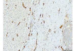 IHC analysis of FABP4 using anti-FABP4 antibody (ABIN7603145).